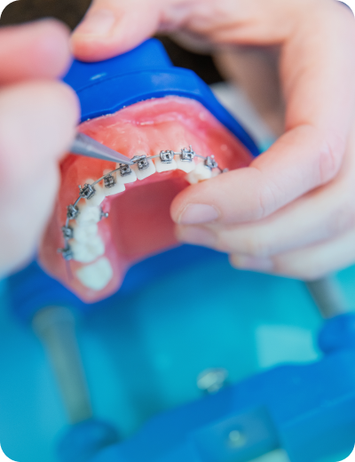 Maîtrise des techniques orthodontiques - EOMAC